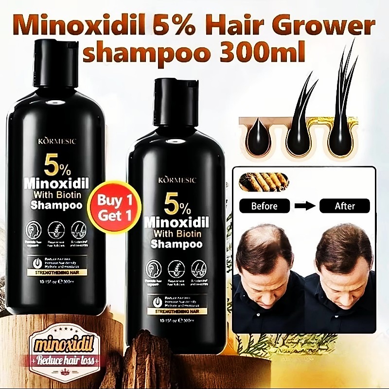 BUY 1 TAKE 1 Minoxidil 5% Shampoo With Biotin Treat Hair Loss and Strengthen Hair Roots 300ml BUY 1 TAKE 1 Minoxidil 5% Shampoo With Biotin Treat Hair Loss and Strengthen Hair Roots 300ml
